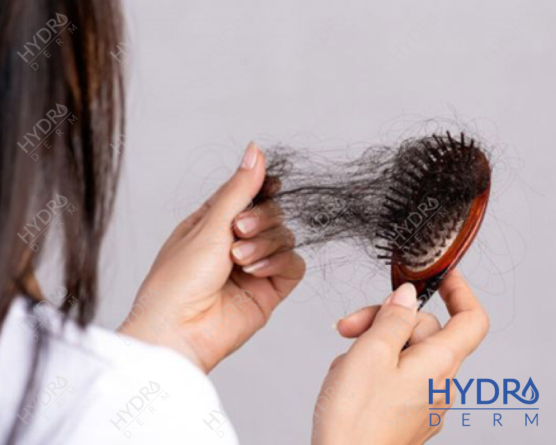 با انواع دلایل ریزش مو و میزان طبیعی آن آشنا شوید